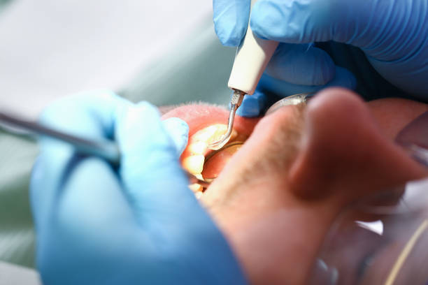 Best Weekend Emergency Dentist in Prunedale, CA