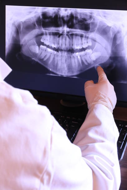 Best Walk-In Emergency Dentist in Prunedale, CA